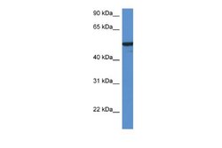 FMO2 Antibody, Novus Biologicals 100 &mu;L | Buy Online | Novus Biologicals | Fisher Scientific
